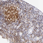 Immunohistochemical staining of human tonsil shows strong membranous positivity in germinal center cells.