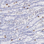 Immunohistochemical staining of human duodenum shows strong membranous positivity in enteroendocrine cells.
