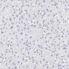 Immunohistochemical staining of human liver shows no membranous positivity in hepatocytes as expected.