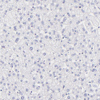 Anti-LRMP Antibody