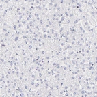 Immunohistochemical staining of human liver shows no membranous positivity in hepatocytes as expected.