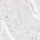 Anti-LRMP Antibody