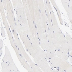 Immunohistochemical staining of human skeletal muscle shows no membranous positivity in myocytes as expected.