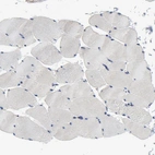 Immunohistochemical staining of human skeletal muscle shows low expression as expected.