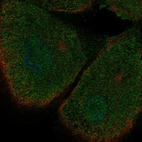 Immunofluorescent staining of human cell line RPTEC TERT1 shows localization to nucleoplasm, plasma membrane & cytosol.