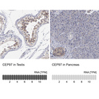 Anti-CEP97 Antibody