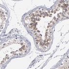 Immunohistochemical staining of human testis shows high expression.