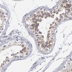 Anti-CEP97 Antibody