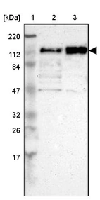 Lane 1: Marker [kDa] 220, 112, 84, 47, 32, 26, 17_br/_Lane 2: Human cell line RT-4_br/_Lane 3: Human cell line U-251MG sp