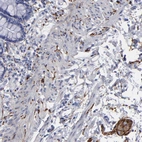 Immunohistochemical staining of human rectum shows strong positivity in peripheral nerve / ganglion.