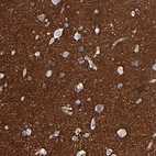 Immunohistochemical staining of human cerebral cortex shows strong positivity in neuropil.