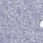 Anti-CADM3 Antibody