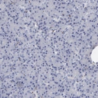 Immunohistochemical staining of human pancreas shows low positivity in exocrine glandular cells as expected.