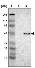 Lane 1: Marker [kDa] 206, 113, 82, 49, 32, 26, 18_br/_Lane 2: Human cell line RT-4_br/_Lane 3: Human cell line U-251MG sp