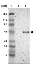 Lane 1: Marker [kDa] 206, 113, 82, 49, 32, 26, 18_br/_Lane 2: Human cell line RT-4_br/_Lane 3: Human cell line U-251MG sp