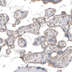 Immunohistochemical staining of human placenta shows moderate membranous positivity in trophoblastic and endothelial cells.
