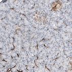 Immunohistochemical staining of human pancreas shows strong membranous positivity in endothelial cells.