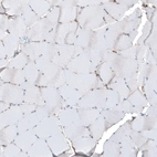 Immunohistochemical staining of human skeletal muscle shows no positivity in myocytes as expected.