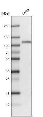 Western blot analysis in human lung tissue.