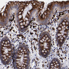 Anti-CTSS Antibody