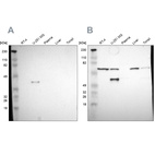 Western blot analysis using Anti-SPARC antibody HPA002989 (A) shows similar pattern to independent antibody HPA003020 (B).