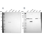 Western blot analysis using Anti-SPARC antibody HPA002989 (A) shows similar pattern to independent antibody HPA003020 (B).