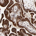 Anti-ELP2 Antibody