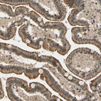Immunohistochemical staining of human duodenum shows strong granular cytoplasmic positivity in glandular cells.