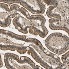 Immunohistochemical staining of human duodenum shows strong granular cytoplasmic positivity in glandular cells.