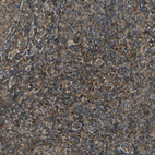 Immunohistochemical staining of human tonsil shows strong strong granular cytoplasmic positivity in non-germinal center cells.