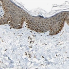 Immunohistochemical staining of human skin shows strong granular cytoplasmic positivity in squamous epithelial cells.