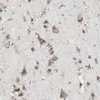 Immunohistochemical staining of human cerebral cortex shows strong granular cytoplasmic positivity in neurons.