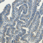 Anti-CTSD Antibody