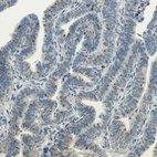 Immunohistochemical staining of human fallopian tube shows moderate granular cytoplasmic positivity in glandular cells.