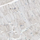 Immunohistochemical staining of human skeletal muscle shows occasional granular cytoplasmic positivity in a subset of myocytes.