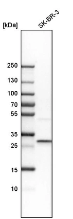 Western blot analysis in human cell line SK-BR-3.