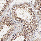 Anti-ARMT1 Antibody