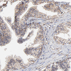 Anti-ARMT1 Antibody