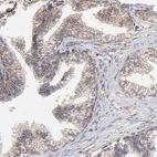 Immunohistochemical staining of human prostate shows moderate membranous positivity in glandular cells.