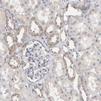 Immunohistochemical staining of human kidney shows weak cytoplasmic positivity in cells in tubules.