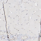 Immunohistochemical staining of human skeletal muscle shows no positivity in myocytes as expected.