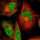 Immunofluorescent staining of human cell line U-251 MG shows localization to nucleus, nuclear bodies & cytosol.