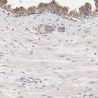 Anti-PDE4B Antibody