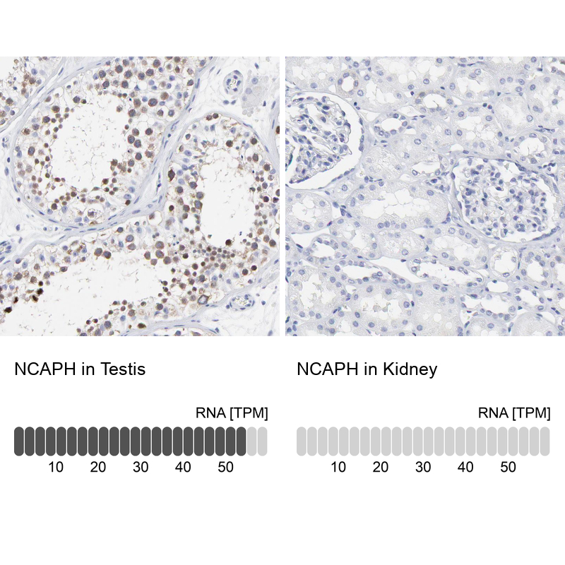 Anti-NCAPH Antibody