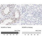 Anti-NCAPH Antibody