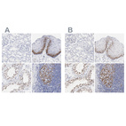 Anti-NCAPH Antibody