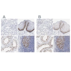 Immunohistochemical staining of human kidney, skin, testis and tonsil using Anti-NCAPH antibody HPA003008 (A) shows similar protein distribution across tissues to independent antibody HPA002647 (B).