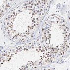 Anti-NCAPH Antibody