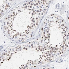 Immunohistochemical staining of human testis shows positivity in cells in seminiferous ducts.
