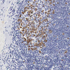 Anti-NCAPH Antibody